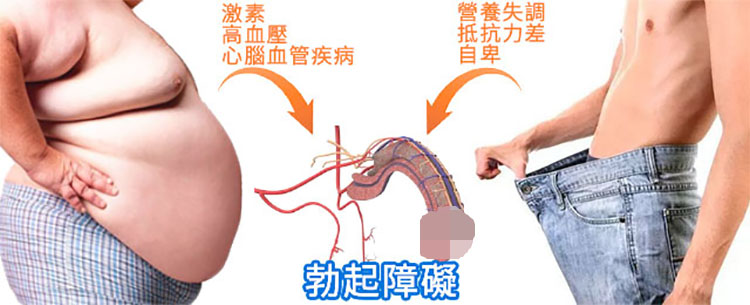 肥胖男性健康問題示意圖，說明體重過重對勃起功能的影響